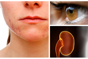 Quali organi colpisce l'eccesso di stress?