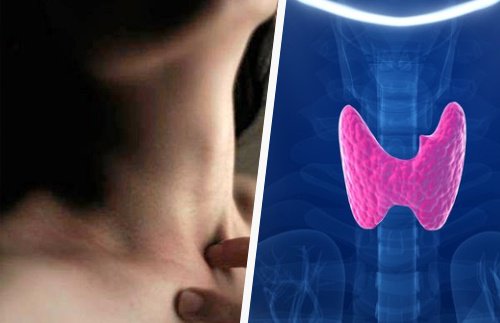 Alterazioni della tiroide causate da 6 cattive abitudini