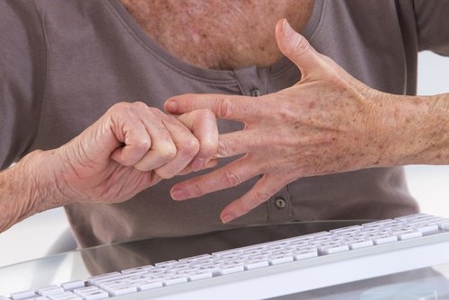 artrite mani malattia di lyme