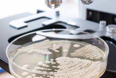 Fermare la candida grazie a 10 alimenti