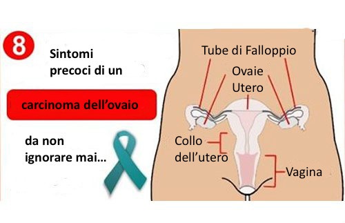 carcinoma ovaio è uno dei tumori ginecologici