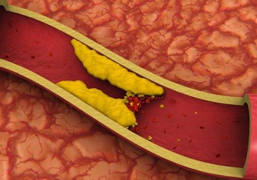 8 infusi naturali per ridurre il colesterolo