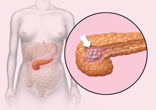 disegno del pancreas