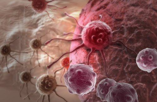 Cancro alla tiroide