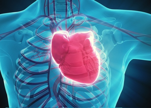 ostruzione arterie coronarie