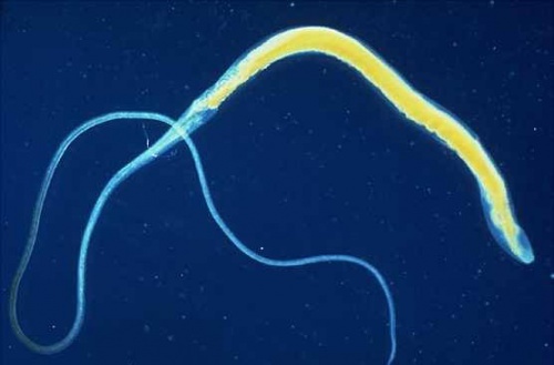 I parassiti intestinali