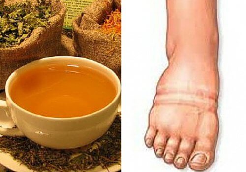 La ritenzione idrica: le migliori piante per combatterla