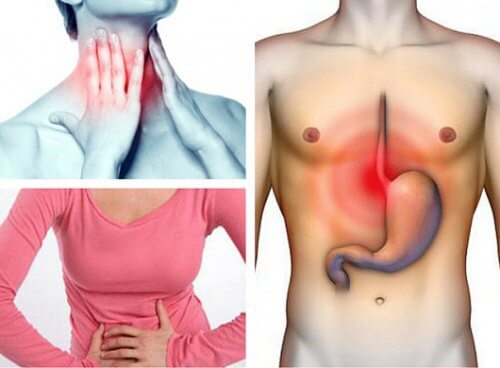 Il reflusso gastroesofageo: ne soffrite senza saperlo?