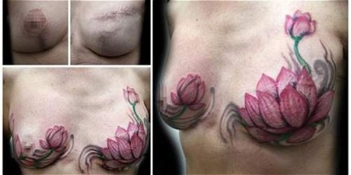 tatuaggi su cicatrici della vita di una donna