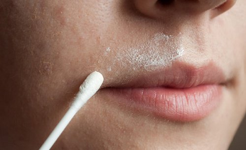 Eliminare i peli del viso in modo naturale