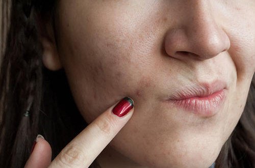 Cura della pelle: 7 sbagli che vanno evitati