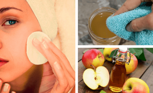 Aceto di mele sulla pelle: tutti i benefici