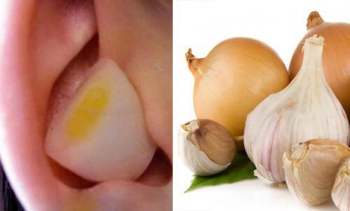 Aglio e cipolla nelle orecchie: perché può essere utile?