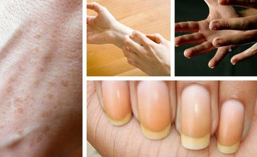 Le mani dicono molto sulla nostra salute