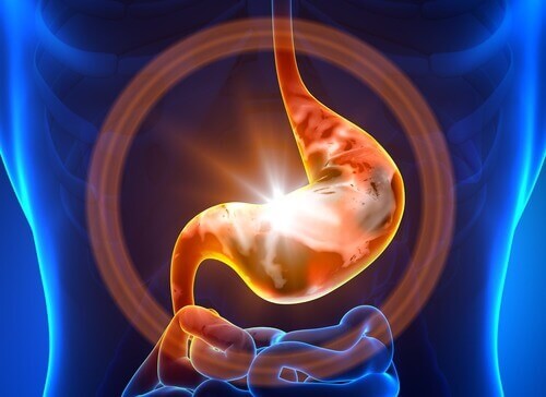 10 possibili cause della gastrite