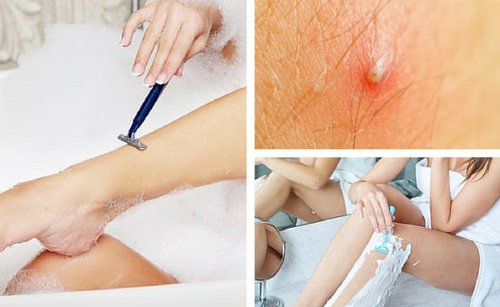 Crema depilatoria naturale: come prepararla per evitare i peli incarniti