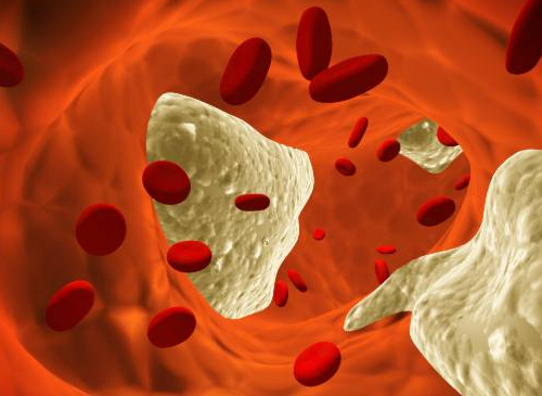 Colesterolo-nel-sangue