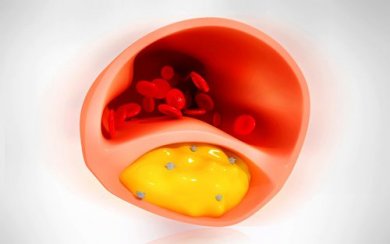 Alimenti per pulire le arterie da includere nella dieta