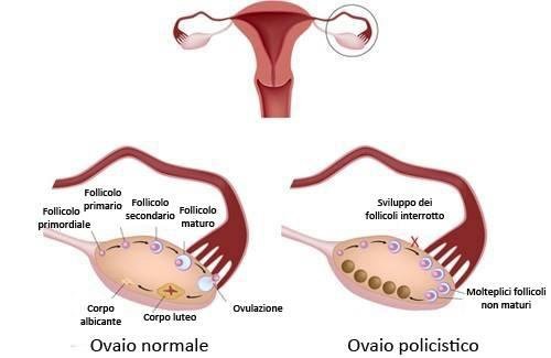 Anatomia delle ovaie