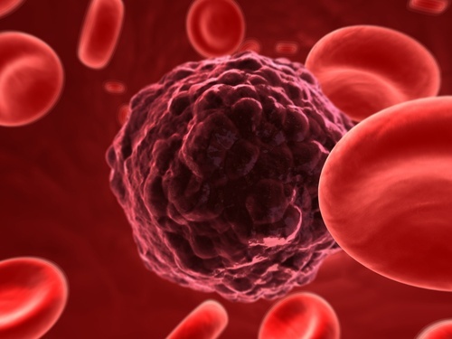 cellule-cancerose-500x375