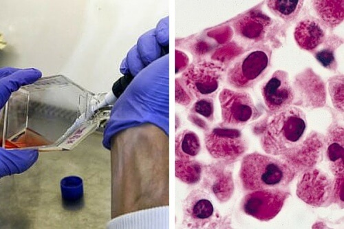 Nuove scoperte nella ricerca contro la leucemia