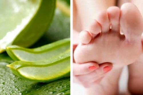 Funghi dei piedi: come combatterli con l'aloe vera