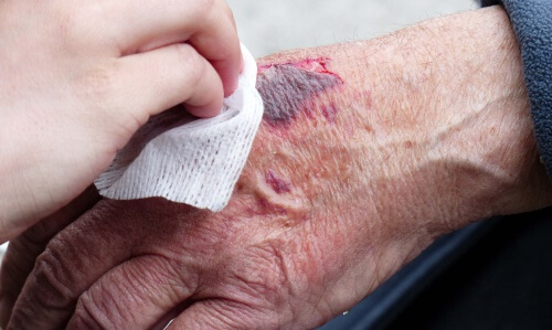 Errori da evitare durante il primo soccorso