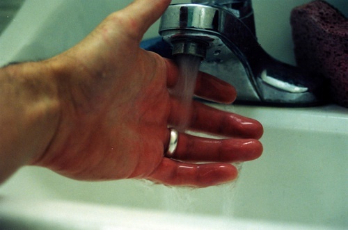Mettere un ustione sotto l'acqua