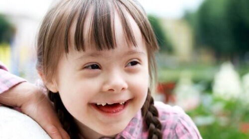 Bambina affetta da sindrome di Down