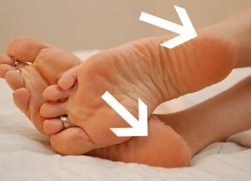 Perché prudono i talloni? I rimedi per un disturbo comune