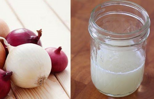 Succo di cipolla per controllare la caduta dei capelli Succo di cipolla per controllare la caduta dei capelli