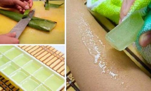 I vantaggi di congelare il gel di aloe vera