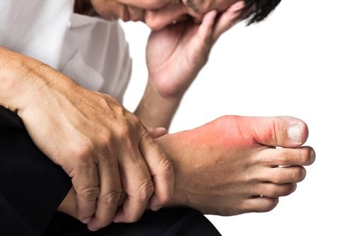 Accumulo di acido urico nei piedi
