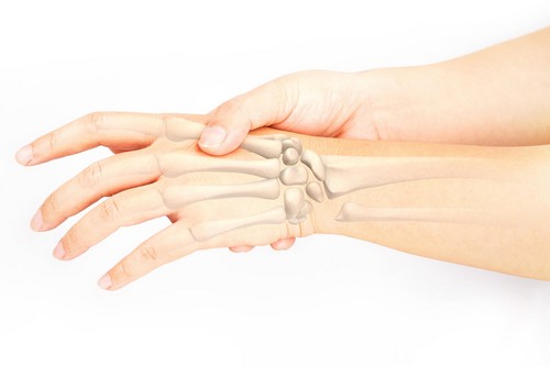 Articolazioni fragili.