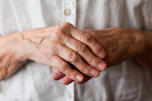 Artrite alle mani e polsi: 8 rimedi naturali