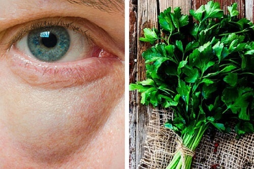 Rimedio al prezzemolo per sgonfiare le palpebre