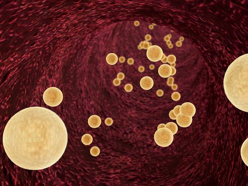 8 ingredienti naturali per controllare i livelli di trigliceridi 8 ingredienti naturali per controllare i livelli di trigliceridi