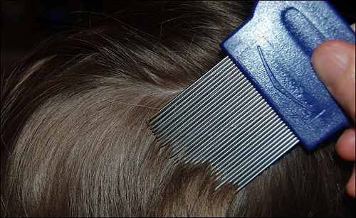 Rimedi naturali per eliminare i pidocchi