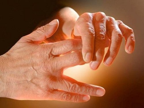 dolore alle mani