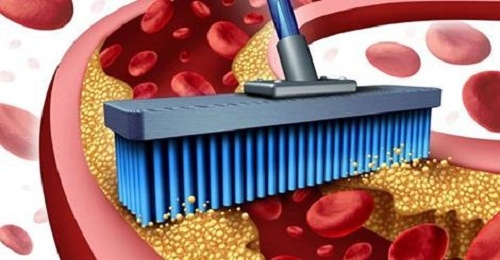 pulire le arterie