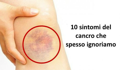 10 sintomi del cancro che spesso ignoriamo