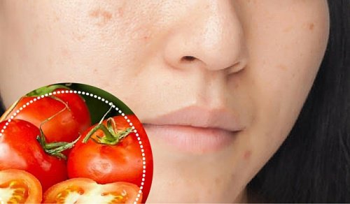 6 ingredienti naturali per attenuare le macchie del viso 6 ingredienti naturali per attenuare le macchie del viso