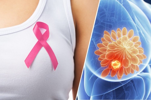 sensore tattile Prevenzione-tumore-al-seno