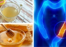 Maschere per la testa con olio di bardana a psoriasi