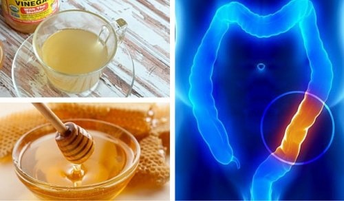 Miele e aceto di mele: due ingredienti per pulire il colon