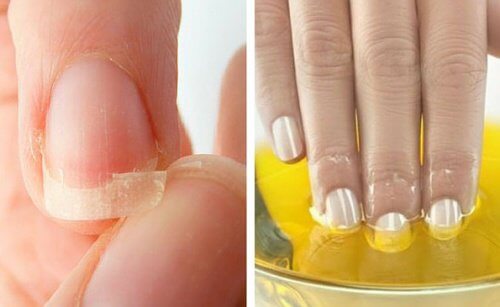 Unghie fragili? Provate questi rimedi naturali
