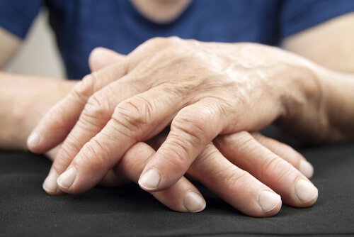 Un nuovo modo di trattare l'artrite