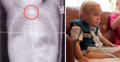 Batterie a bottone: attenzione ai bambini!