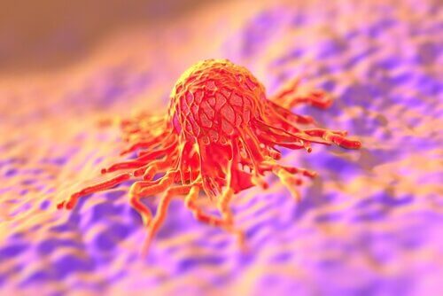 cellula tumorale cancro collo utero