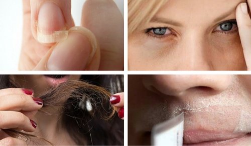 Problemi estetici comuni che potrebbero rivelare disturbi più gravi Problemi estetici comuni che potrebbero rivelare disturbi più gravi